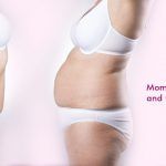 mommy-makeover-surgery