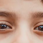 treating-glaucoma