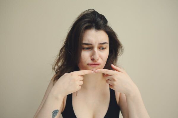 How to Fix a Painful Pimple